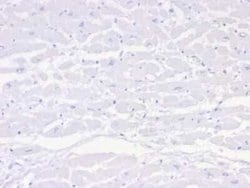 Negative Control for Mouse Monoclonal Antibody, Clone: IGG1/453, Novus